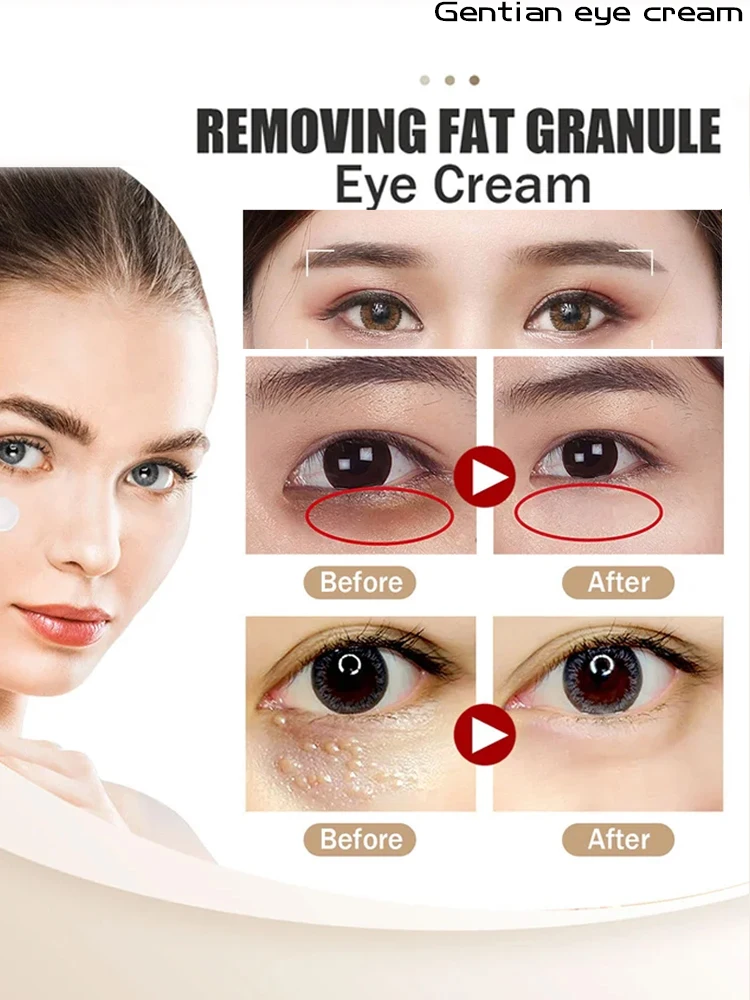 Effectively eliminate eye puffiness, fade black circles