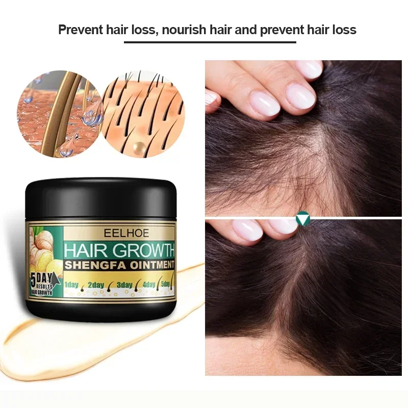 EELHOE Ginger Hair Ointment 5 Days Ginger Essence Repair Damaged Scalp Prevent Hair Loss Fast Hair Growth Massage Cream 30ml
