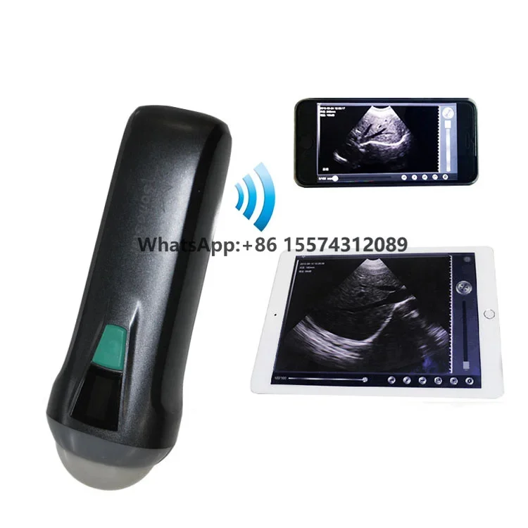 

JQ-C1 Sector Meccanic Probe for human Obstetrics veterinary use ultrasound probe