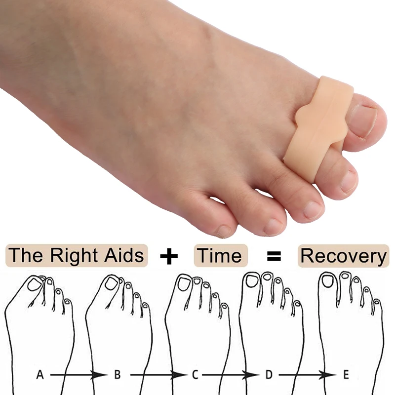 Pexmen Bunion Corrector Zehenspreizer mit 2 Schlaufen, Big-Toe-Abstandshalter für Ballenzehen und überlappende Zehen, reduziert Schmerzen, Fußpflege-Werkzeug