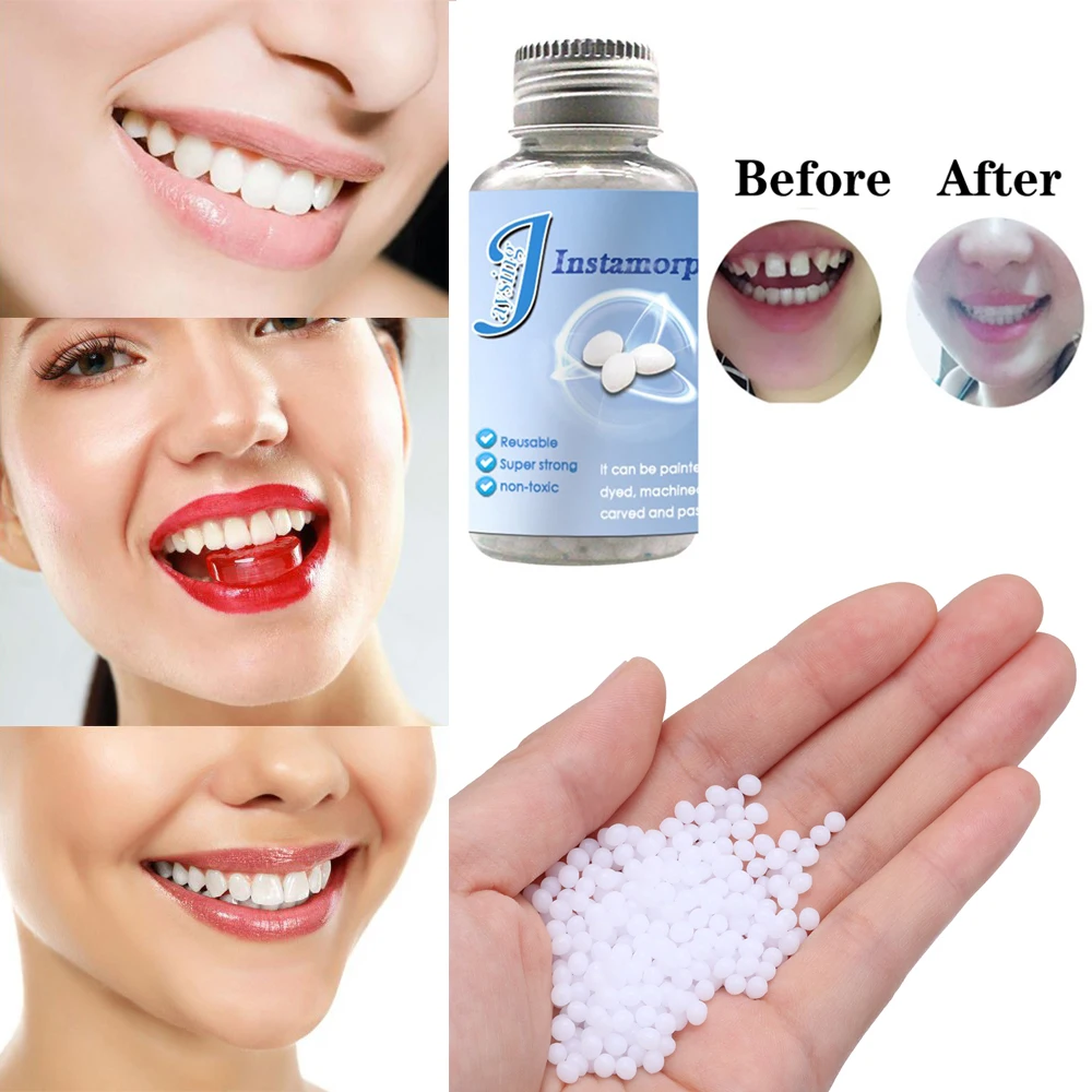 False Teeth Solid Glue Tooth Replacement Material Temporary Tooth Filling Material Tooth Repair Kit Denture Solid Tooth Gel