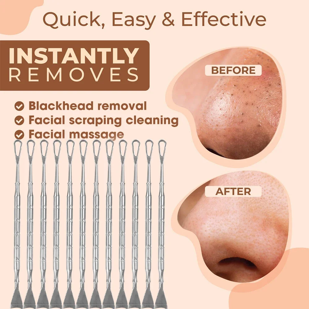 Stainless Steel Blackhead Acne Push Double-Headed Acne Needle Face Scraping Cleaning Flat Pusher Dead Skin Removal Nasal Pusher