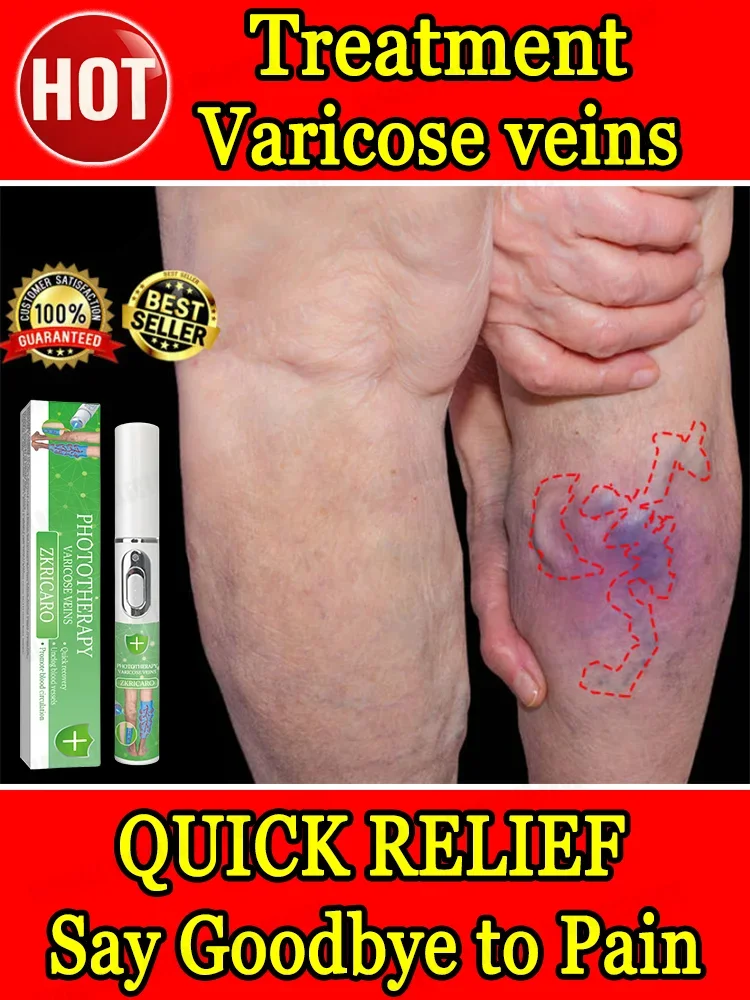 venous inflammation