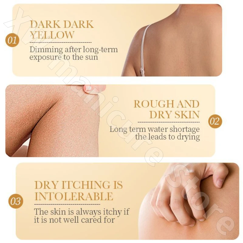 Moisturizing Anti-dry and Anti-itch Body Lotion To Improve Dry Peeling Skin Snake Skin and Fish Scale Skin Body Lotion 200g
