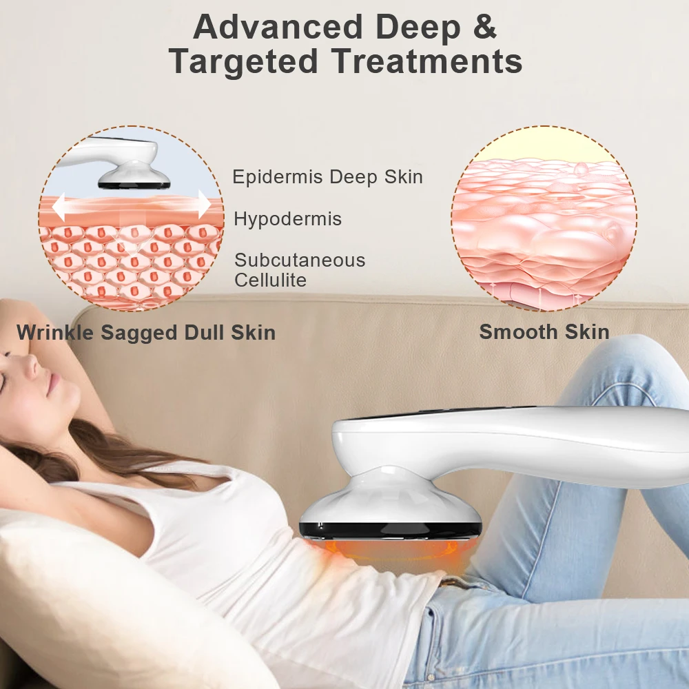 Electric Vibrating Cellulite Massager Anti Cellulite Fat Burner Lose Weight Muscle Stimulator Body Massager for Belly Waist Arm
