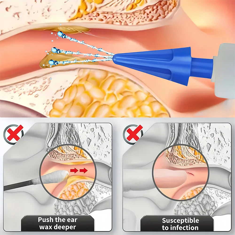 Thumbnail 4 - #7 Latest Ear Syringes Offers