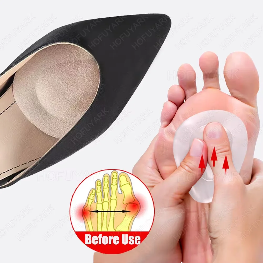 

Silicone Metatarsal Pads Self-Adhesive Forefoot Pads Relieve Foot Pain Forefoot Support Insoles