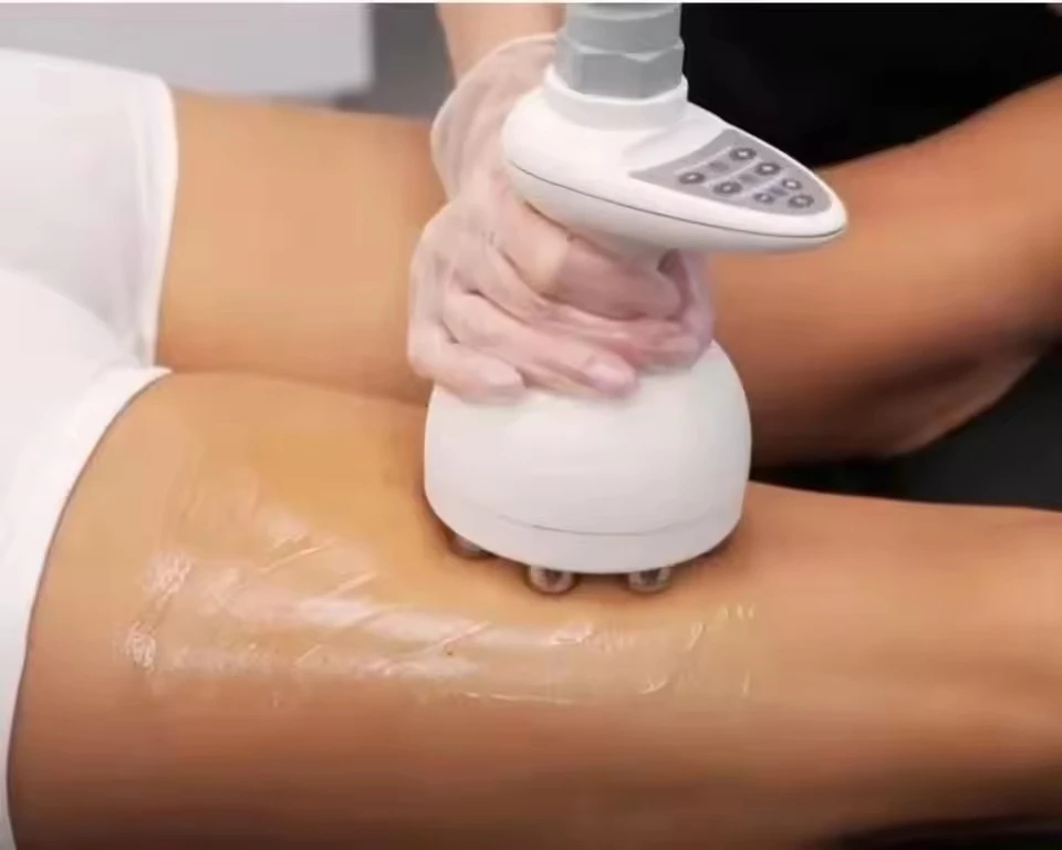 

Venus Legacy Radiofrequency (RF) Technology Non Invasive Skin Tightening Body Contouring Cellulite Reduction Wrinkle Reduction