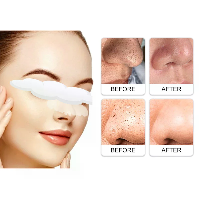 にきびパッチプロフェッショナル鼻のクリーニングとケア目に見えないハイドロゲルステッカー通気性防水ステッカー