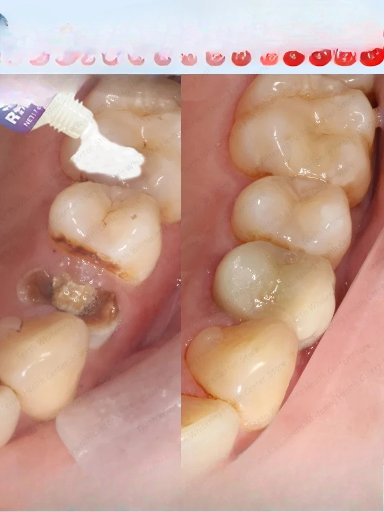 

Carillas Dentils Dentaduras postizas para comer de Silicona Материковый Китай Протез Чистый Нет
