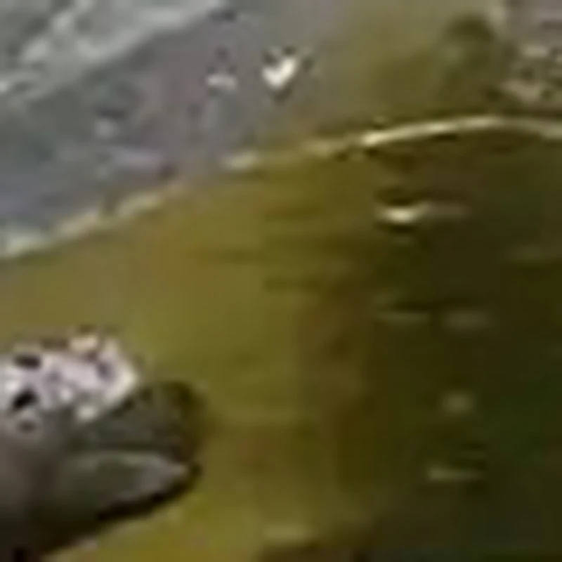 

Medical Sprague Rappaport Professional Doctor Neonatal Adult Nurse Cardiology Estetoscopio Dual Head Gilt Cute Stethoscope C2