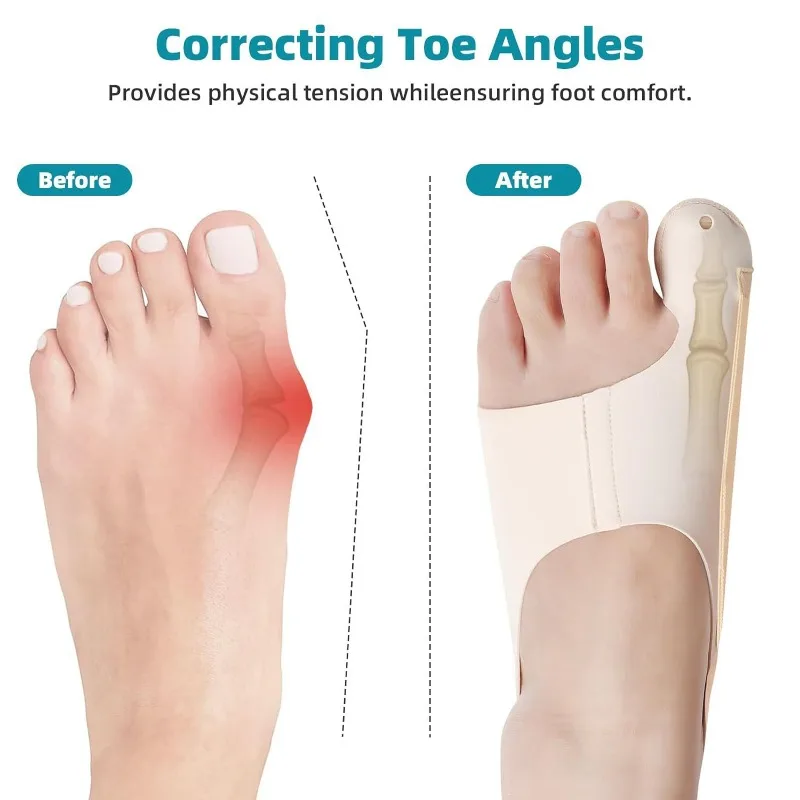 1PC Corrector Hallux Valgus Big Toe Bunion Corrector Orthopedic Socks Toes Separator Women Men Foot Care Toe Pain Relieve Tools