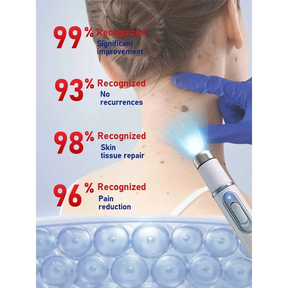 حار yMoleRemoval القلم ثؤلول أداة إزالة البلازما الليزر الجمال العناية بالبشرة الذرة النمش العلامة نيفوس العمر الداكن الاجتياح بقعة الوشم الكهربائية