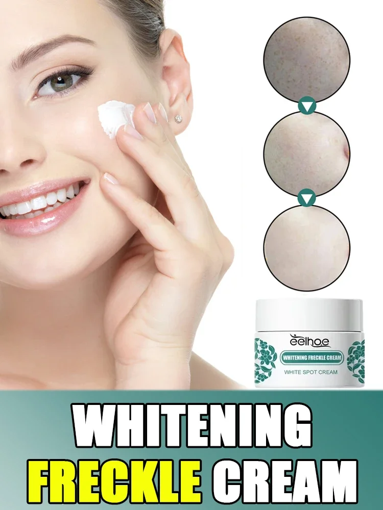 Removal Freckles Dark Spots Brighten Facial Skin Firming Whitening Frckle Cream Products Reduce Melanin Lighten Dark Skin