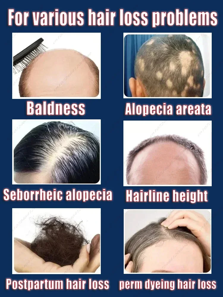 HOLJKEA-Cabelo Regrowth Cap, Anti-Hair Loss, Fortalecer as raízes do cabelo, folículos profundos, promover a rebrota, carregamento USB