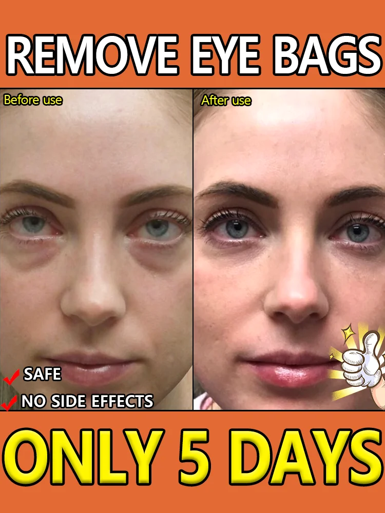 

Это быть приятным опытом покупок. Снимайте в 7-дневных мешках для глаз.