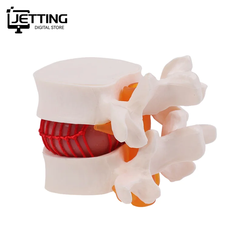 ✍ تشريح الإنسان الهيكل العظمي العمود الفقري قطني القرص فتق نموذج للتدريس الدماغ الجمجمة صدمة اللوازم المدرسية أداة طبية