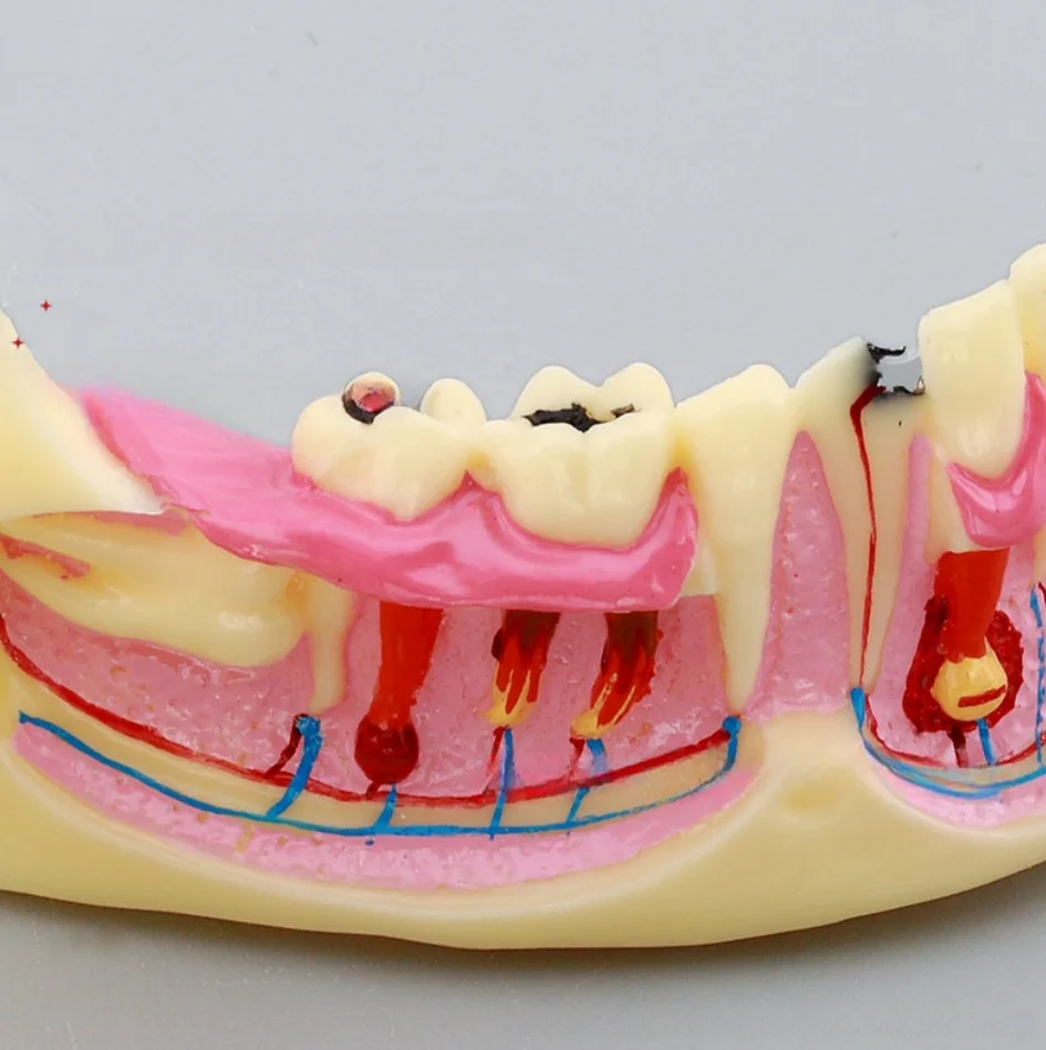 

Dental Low Jaw Endodontic Model Anatomical Model of Right Mandibular Tissue Anatomical of Gingiva for Learning And Teaching