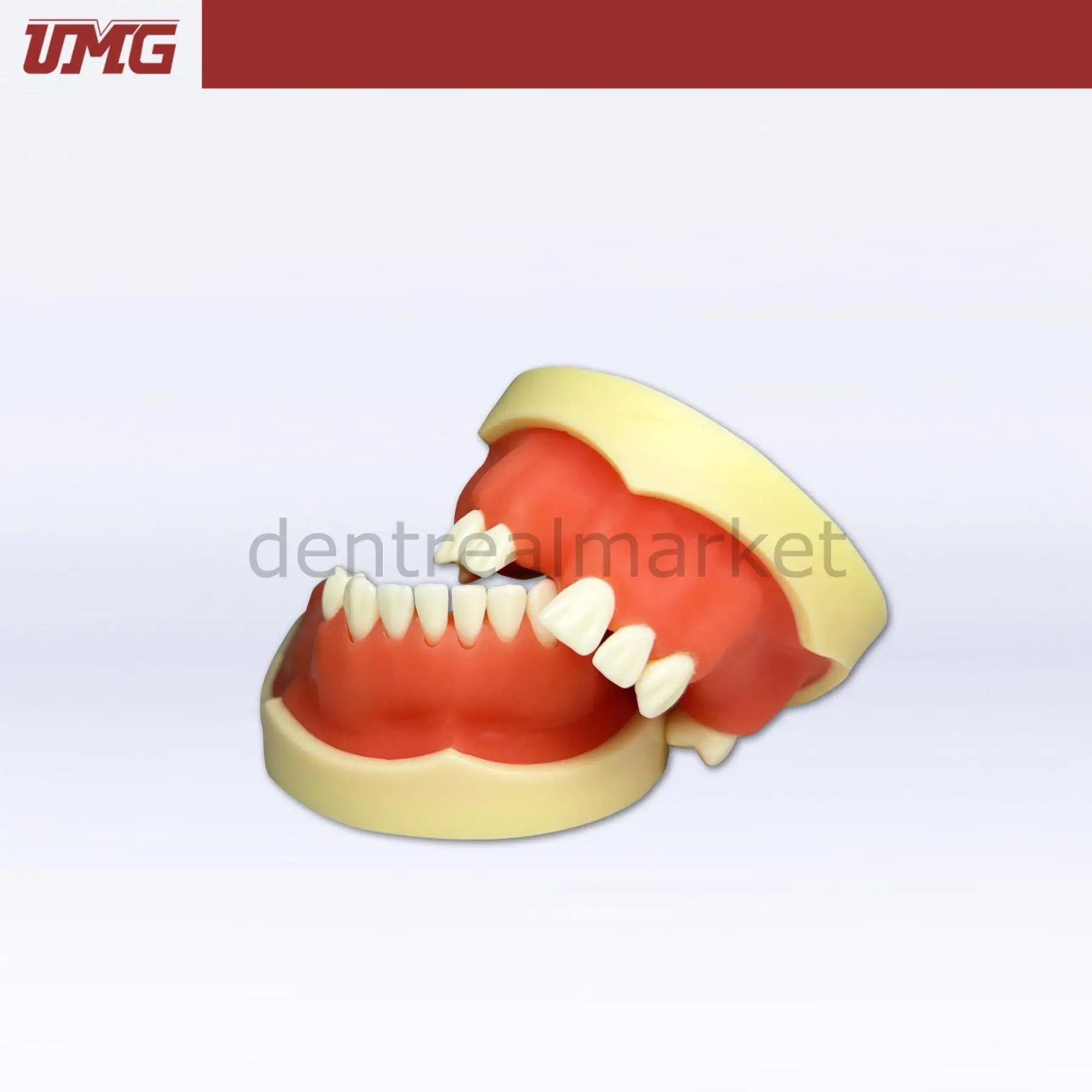 UMG Dental - Umg Model Implant Application Training Model - UM-Z2026