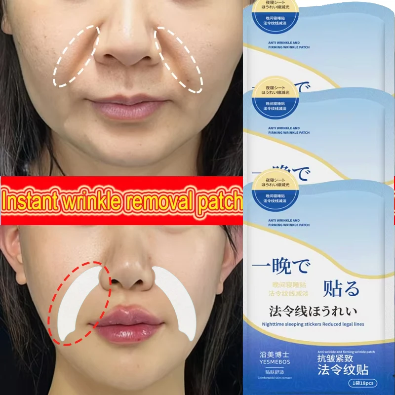 

Патчи для носогубных складок с коллагеном и гиалуроновой кислотой: укрепление кожи, разглаживание морщин, глубокое увлажнение, антивозрастная маска для лица