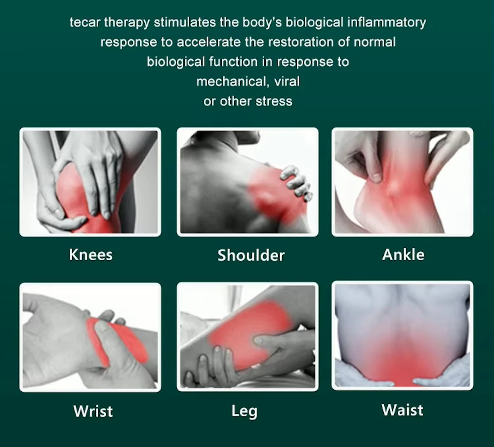 Small Tecar Device 448khz CET Tecar Physical Therapy Knee Joint Pain Relief Tecar RET Rehabilitation Device view 5