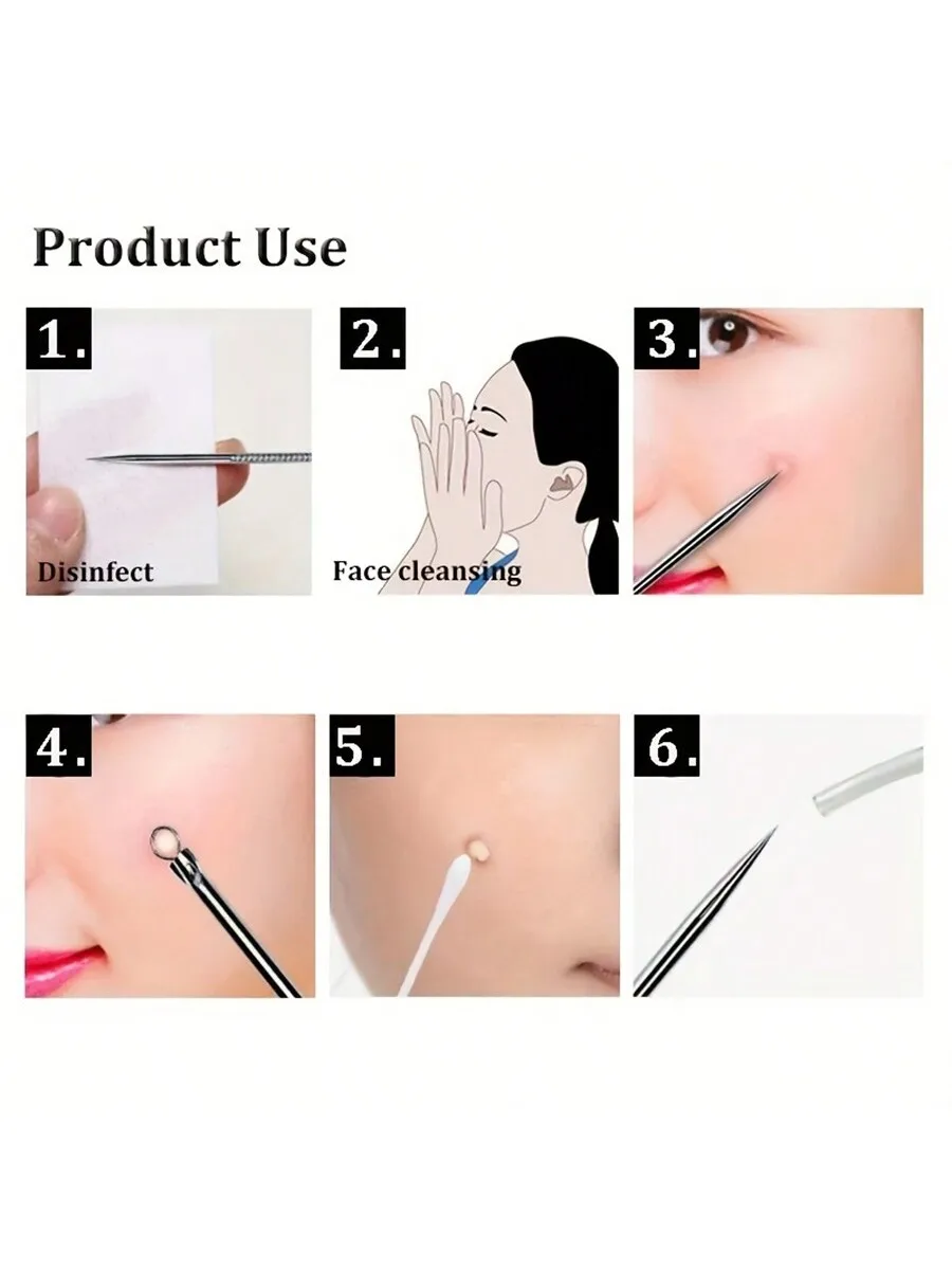 Aguja de acné de acero inoxidable para eliminar puntos negros, eliminar el acné, herramienta para apretar el acné, clip celular, aguja para acné, clip para acné, juego de 4 piezas