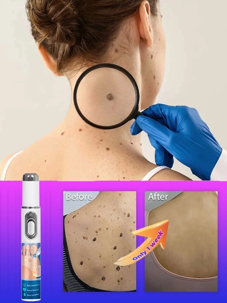 

solve skin problems for everyone