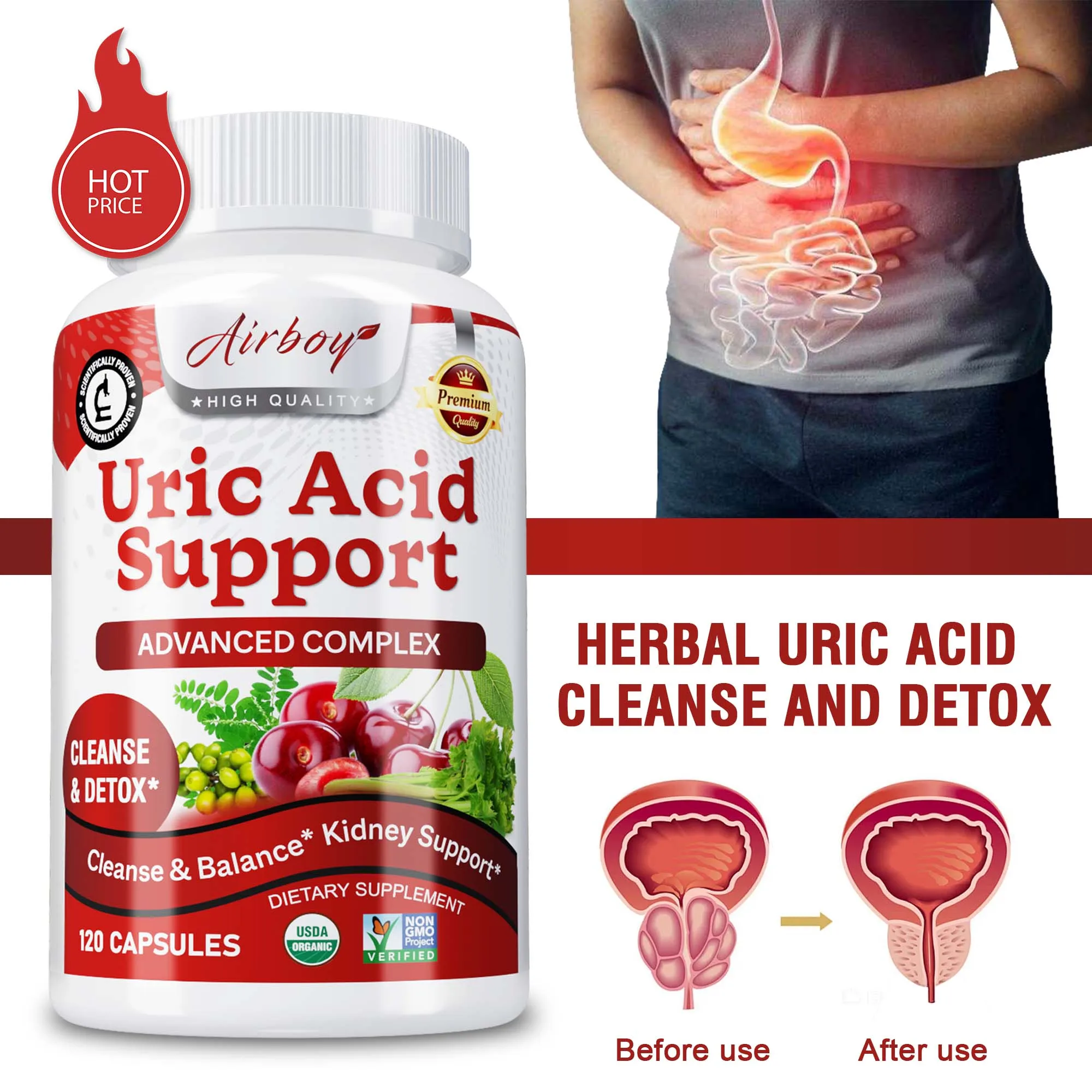 Uric Acid Support Capsules - Uric Acid Cleanse & Kidney Support,Supports Joint & Urinary Tract Health,Relieves Joint Discomfort