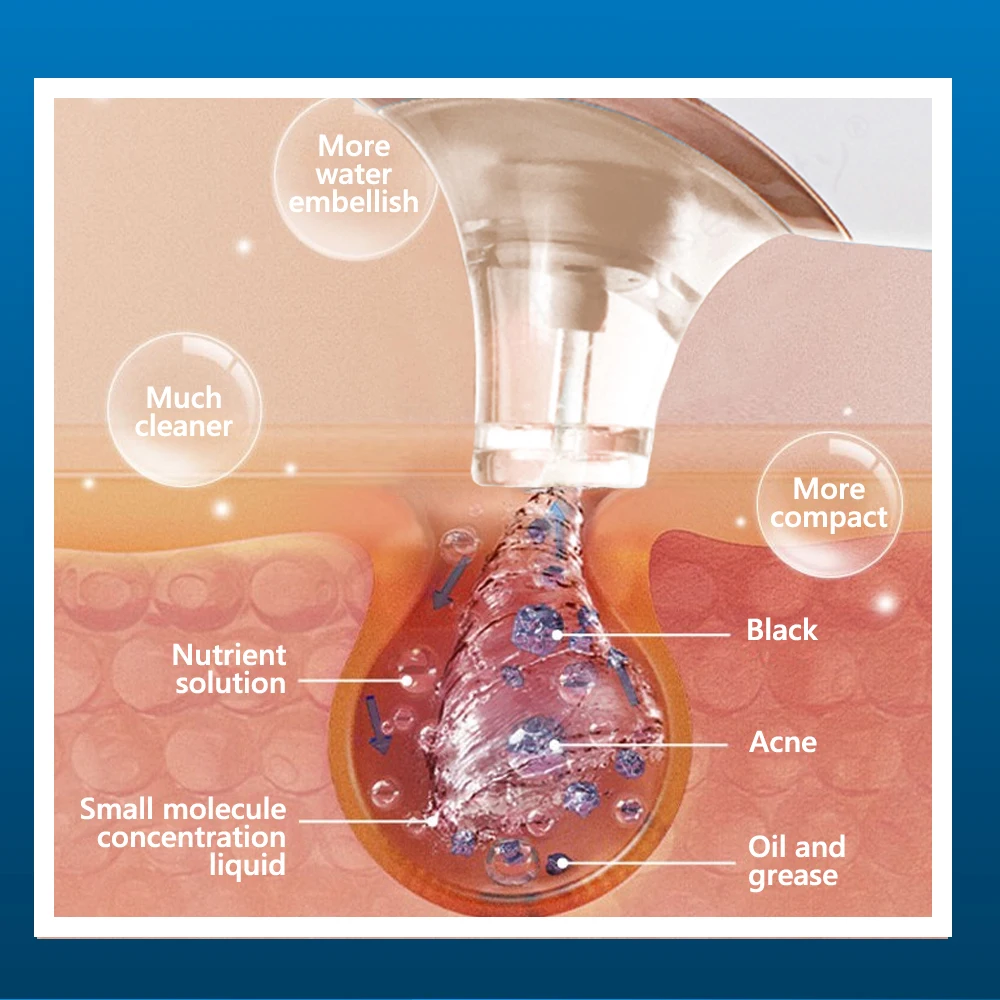 Nettoyeur de pores électrique  - Blackhead Remover Vacuum Suction avis et prix