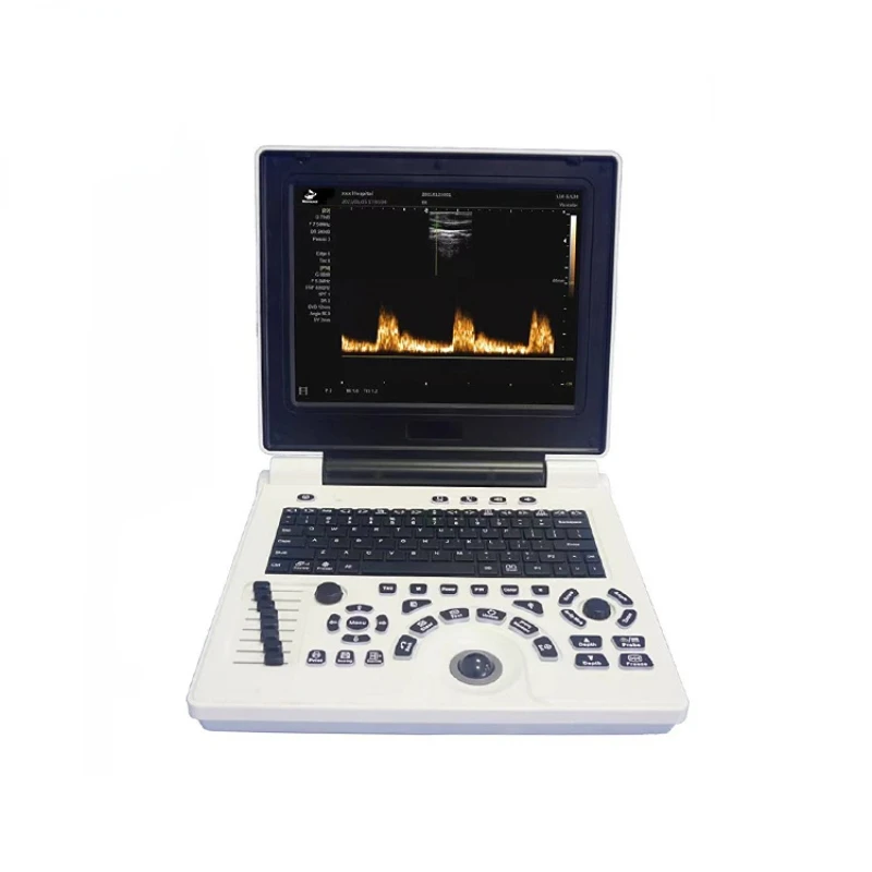 Bioevopeak Laptop type Ultrasound Machine Ultrasound Machine