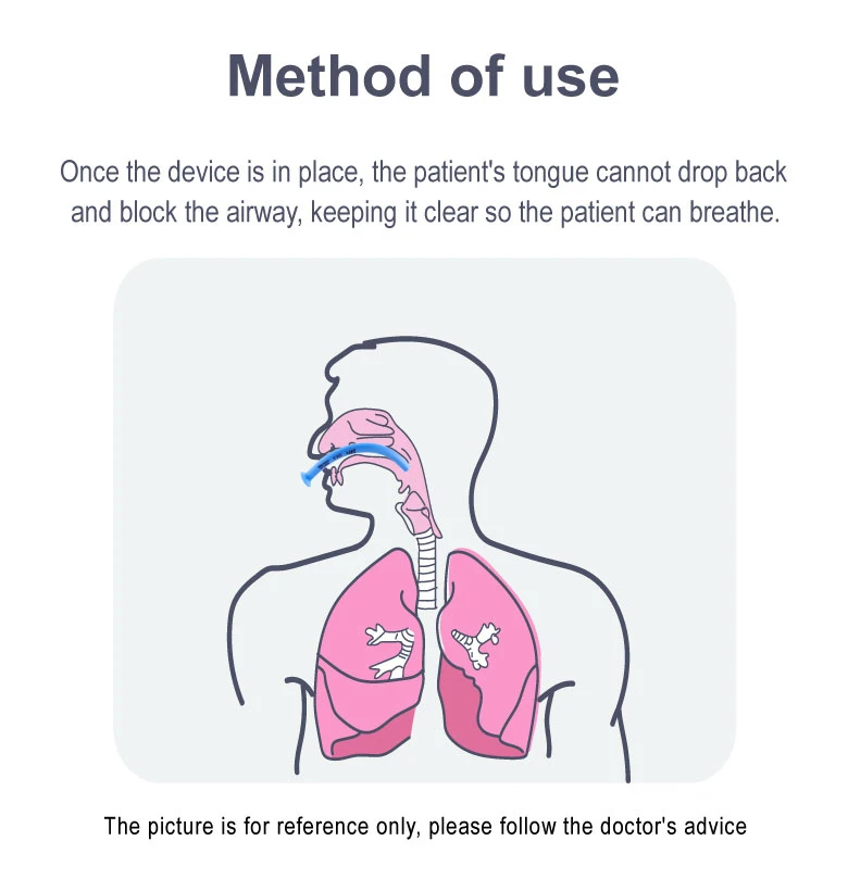 Einweg-Nasopharyngeal Airway Nasal Pharyngeal Duct Atemgasführungsröhre Erste Hilfe Notfall 3,0–8,5 mm 5 Stück/10 Stück/20 Stück – Detail 5
