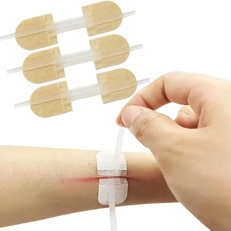 1/3/10/50 Patches Butterfly Closure Bandage Strips Adhesive Strip Stitch Bandages For Closing Skin Wounds With Non-Stick Pad