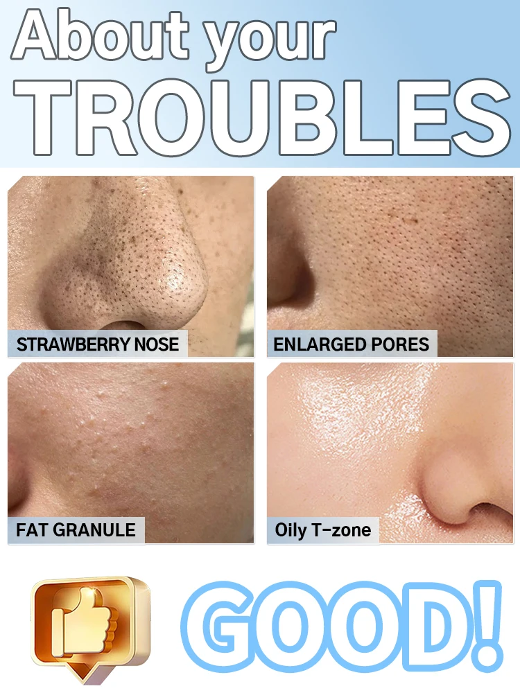 2026 New upgrade Electric Blackhead Remover Device, Professional Pore Cleaner for Black Dots & Facial Skin