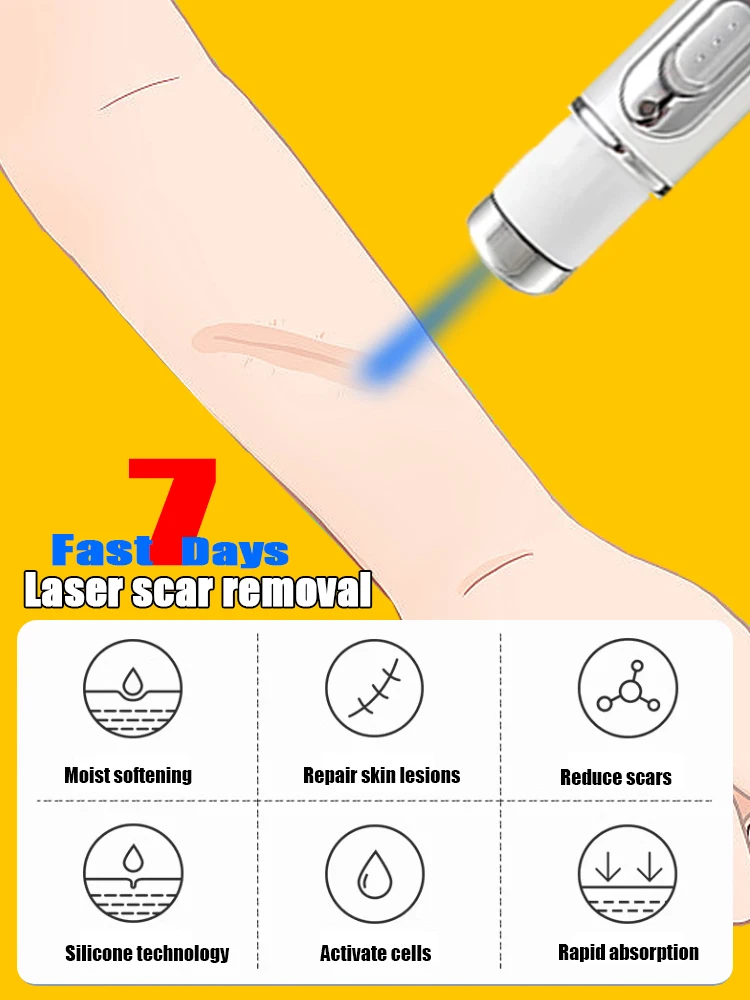 Caneta laser