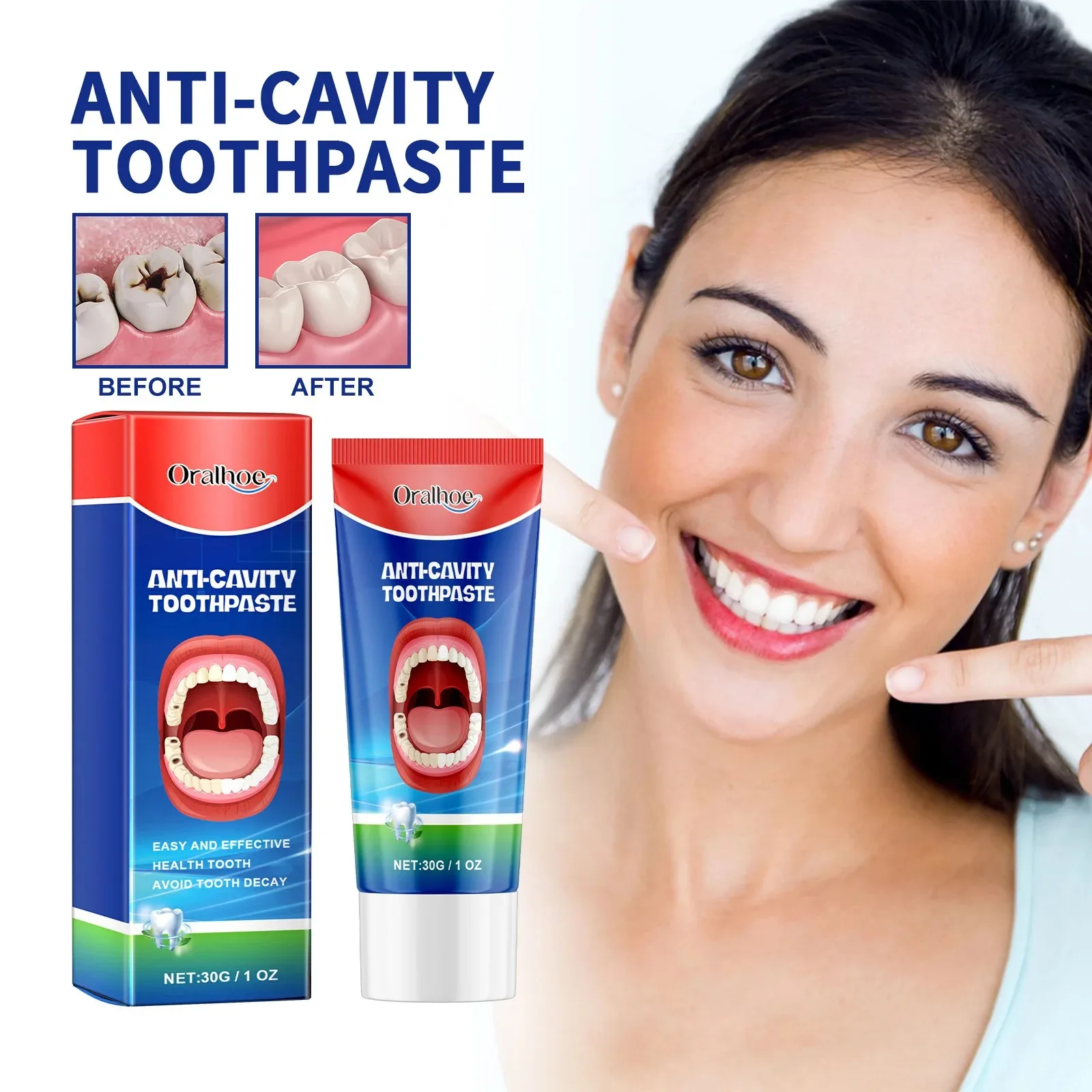 Limpieza profunda, blanqueamiento, aliento fresco, pasta de dientes anticaries, crema reparadora de caries, previene caries, protege los dientes