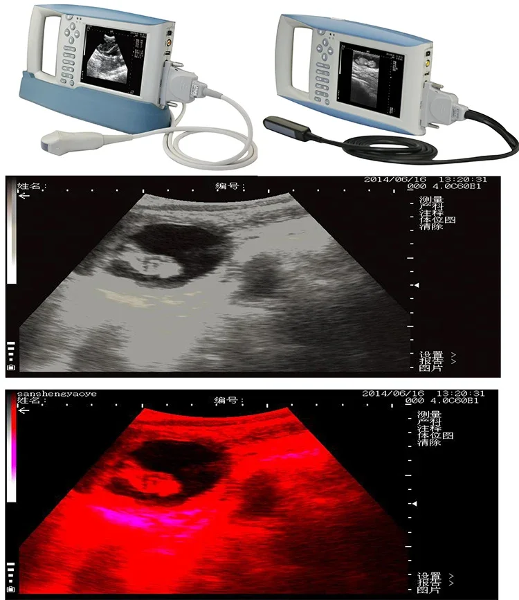 KX-5100 Vet Equipme…