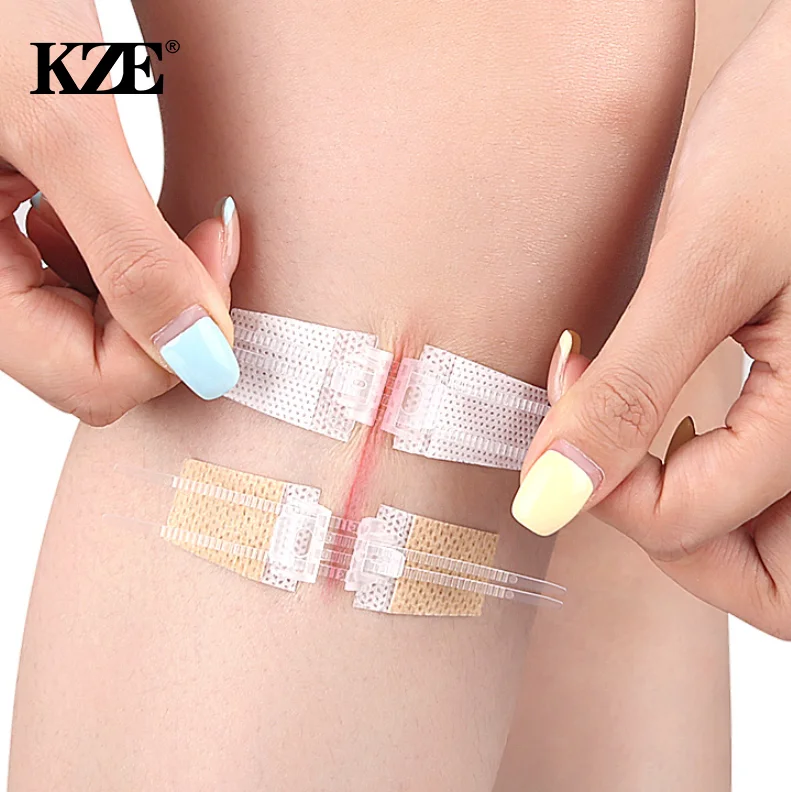 سستة التعادل الجرح إغلاق التصحيح مرقئ التصحيح الجرح سريع دون خياطة سستة في الهواء الطلق الفرقة المعونة المحمولة جلطة سريعة الجرح