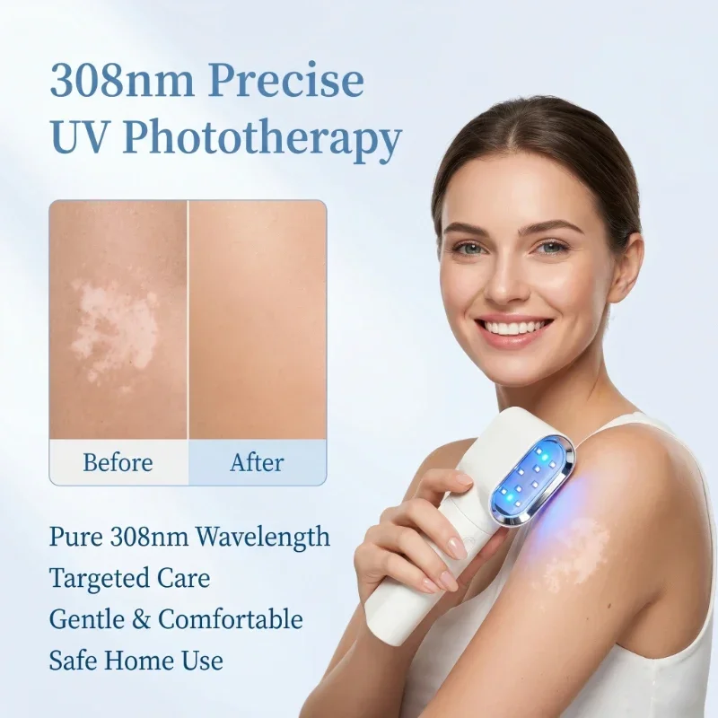 

UV Ultraviolet Phototherapy Lamp Light Therapy Device for Skin Treatment Medical Instrument for Vitiligo Psoriasis