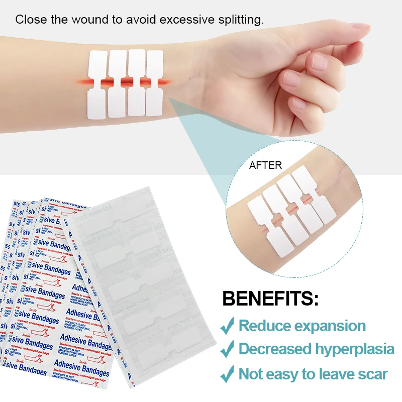 20Pcs Suture-free Wound Closure Device Waterproof Sterile Band Aid Emergency Kit Adhesive Bandage Children\'s Patch Strips A1667