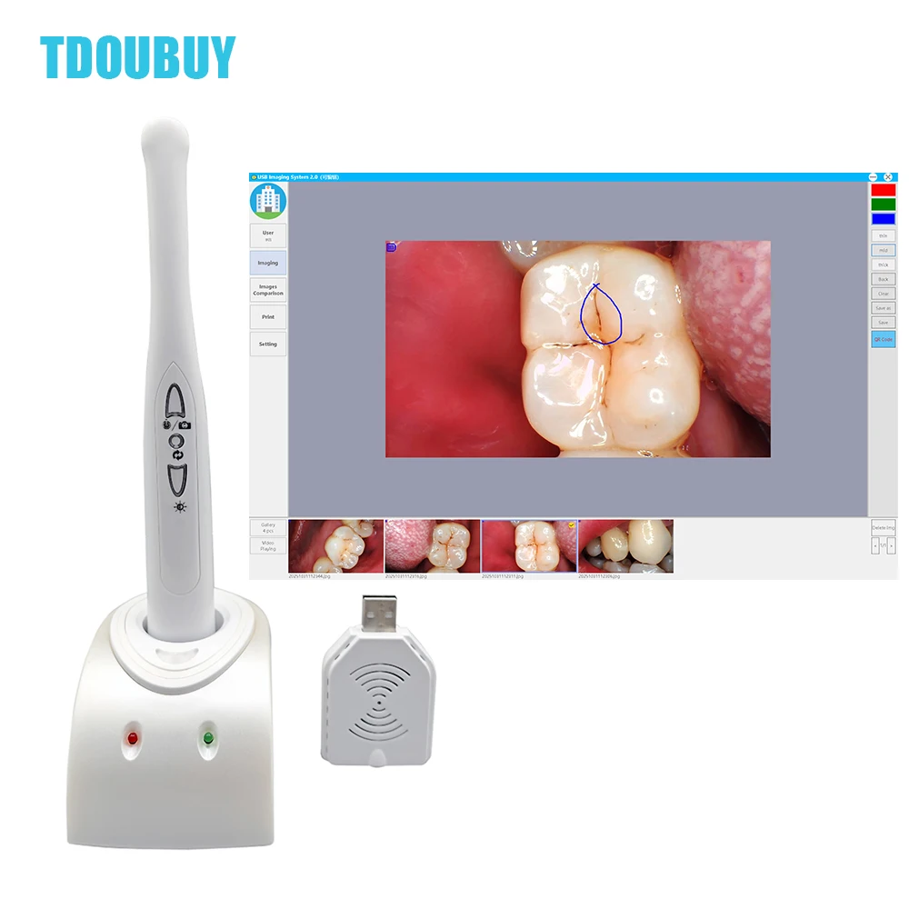TDOUBUY Denspay أحدث عدسة كاميرا لاسلكية واي فاي داخل الفم مع مستشعر صورة 1/4 CCD كاميرا محمولة داخل الفم للأسنان