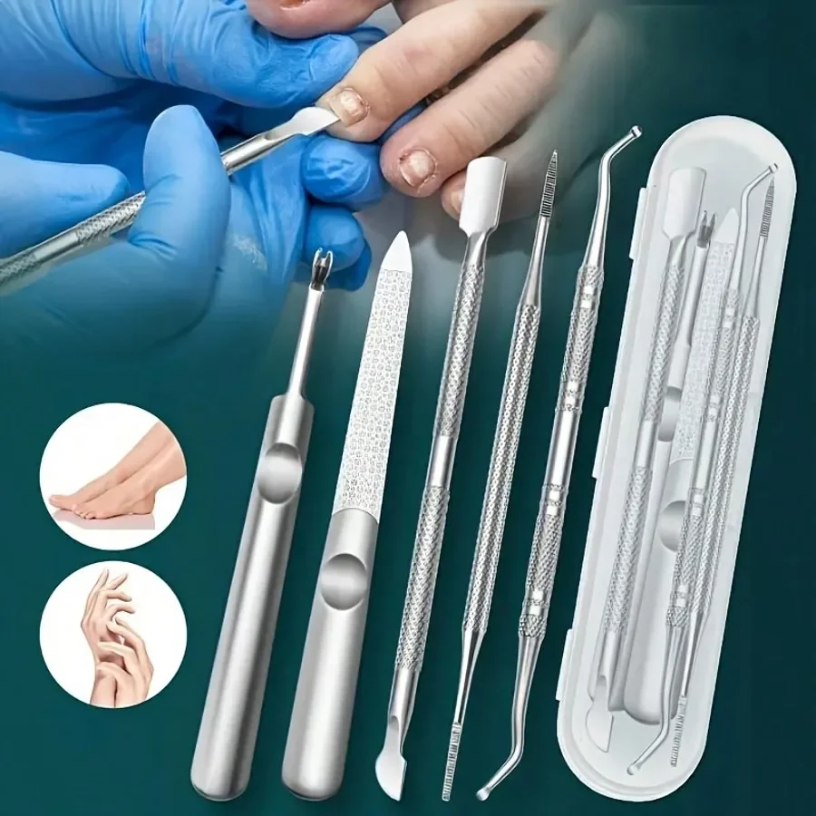5/6PCS 전문 스테인레스 스틸 자란 발톱 깎기 세트-죽은 피부 트리밍 및 페디큐어 관리를위한 정밀 발 치료 도구