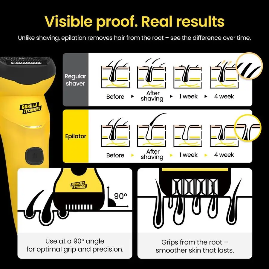 

Technique Epilator 3000V, Body Hair Removal Device, Pain Relief Roller, Cordless Rechargeable Electric Tweezers for Women amp Me