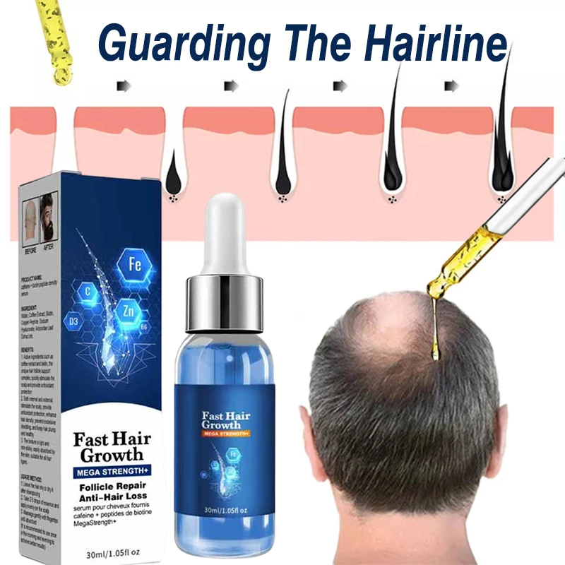 Effective Fast Hair Growth Oil Baldness Repair Hereditary Postpartum Seborrheic Anti Loss