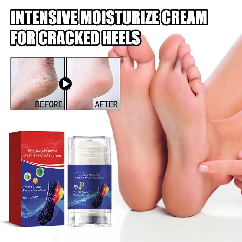 Crack Heel Cracking Repair Products, esfoliação, remoção de pele morta, amolecimento, hidratação, mão, cuidados com os pés, 40g, 1pc