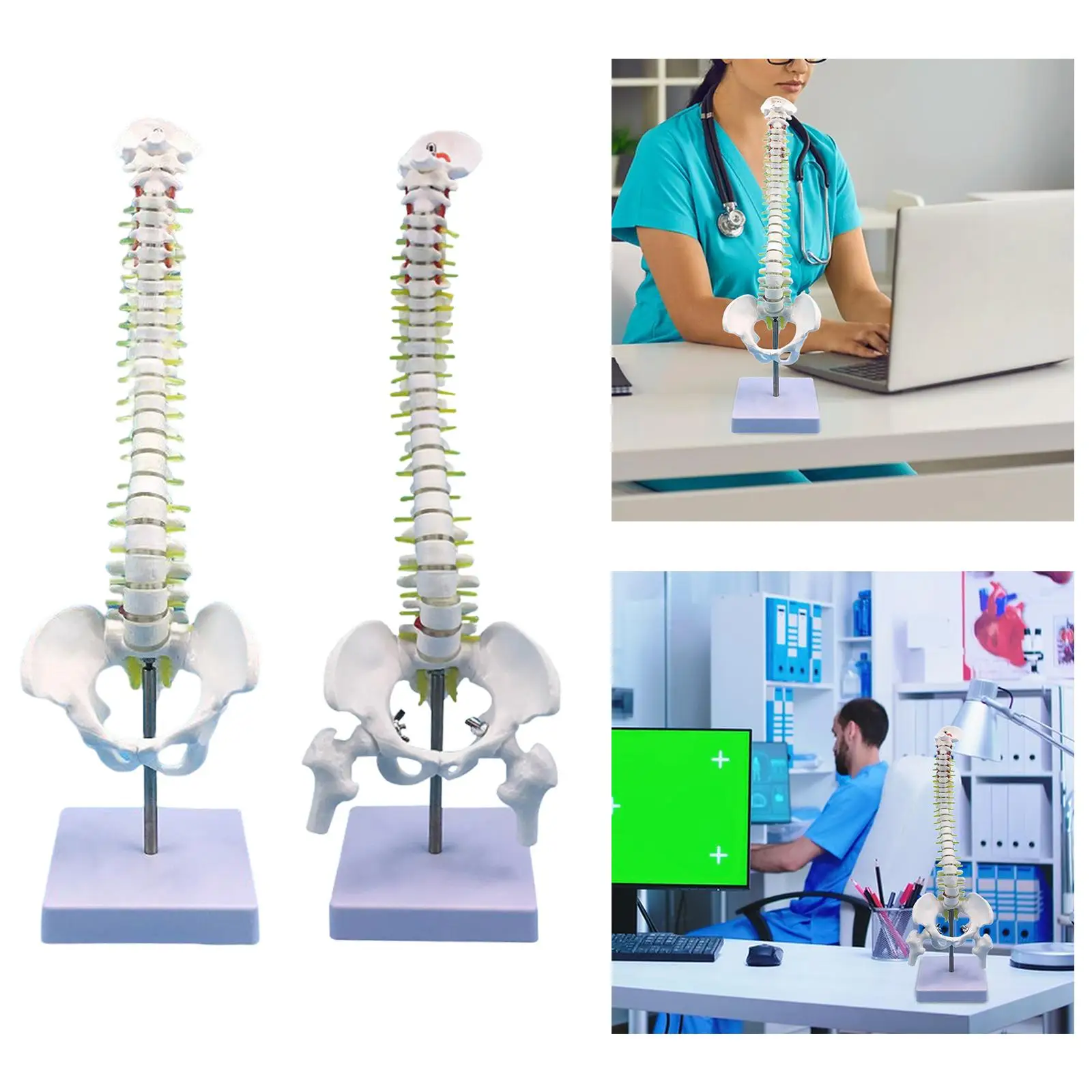 Human Spine Model Skeleton 17.7inch for Teaching Aid Learning Education Tool