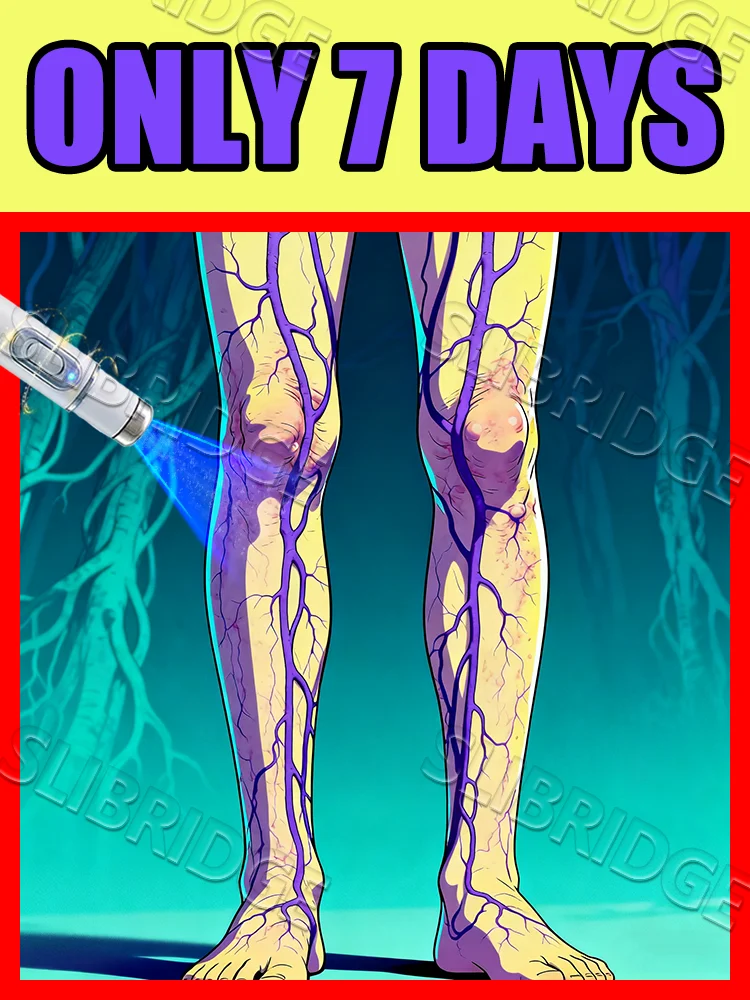 

blue light pen solve veins,veins care tools,free shipping