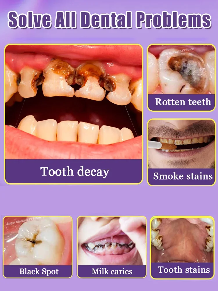 maintain a cavity-free smile