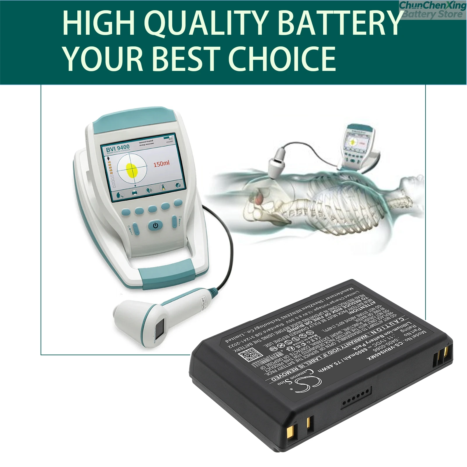 Cameron Sino 11.1V 5000mAh/6800mAh Replacement Battery for Verathon 9400 Bladderscan BVI 9400 0400-0066 0400-0121 0570-0066