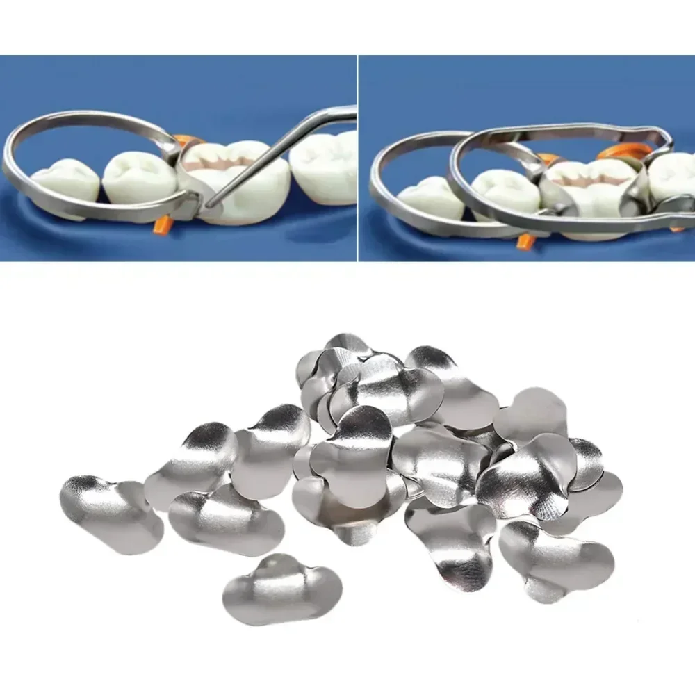 100pcs Dental Matrix System Sectional Contoured Metal Bands, with Autoclavable Clamping Separating Rings Full Teeth