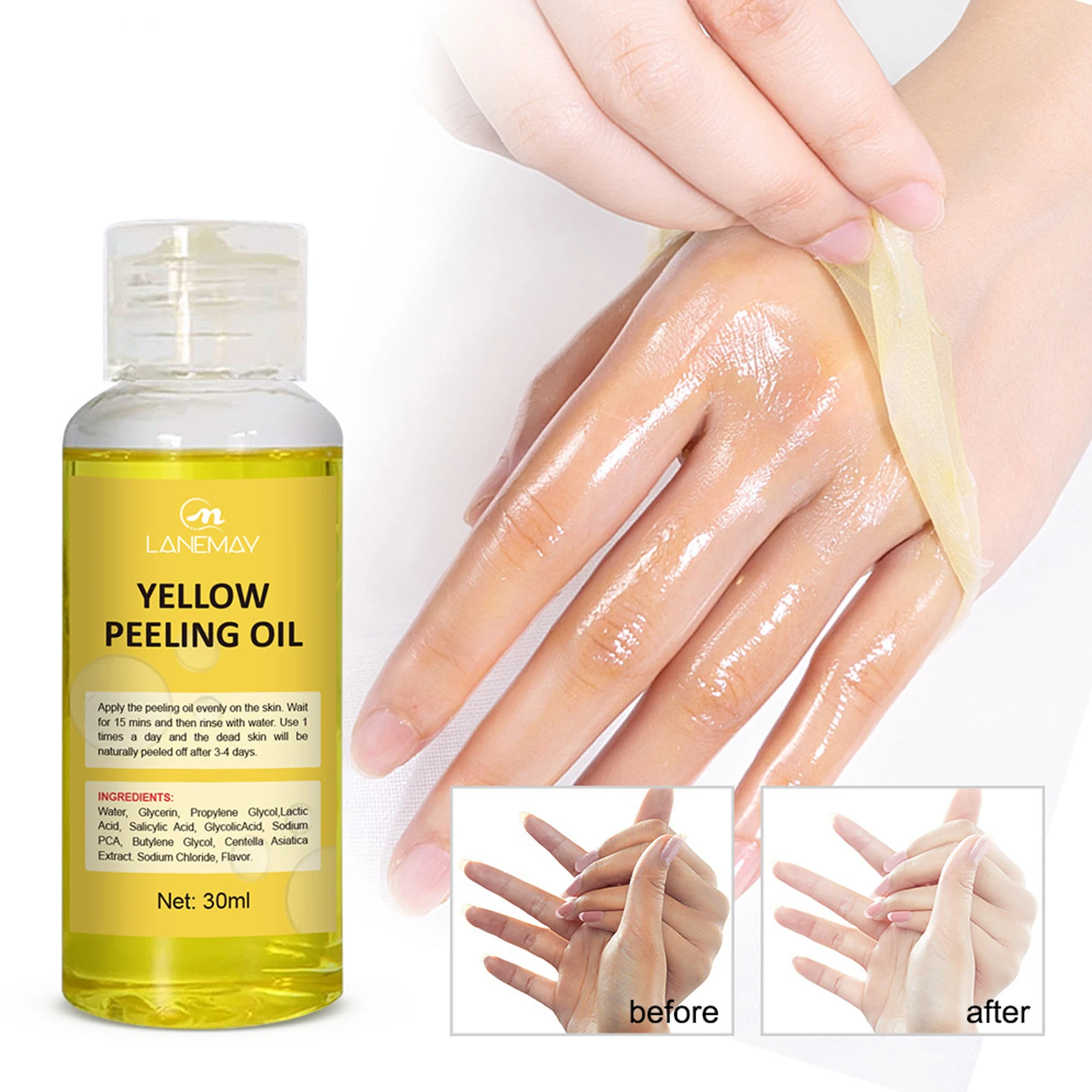 30ml Yellow Peeling Oil Exfoliating Deep Cleaning Remove Dead Skin Moisturizing Desalting Melanin Body Skin Brightening Scrub